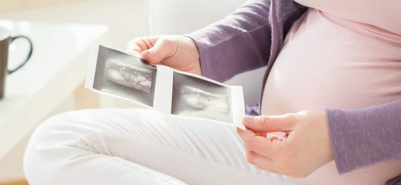 Azia na gravidez: O que é, porque surge e como tratar